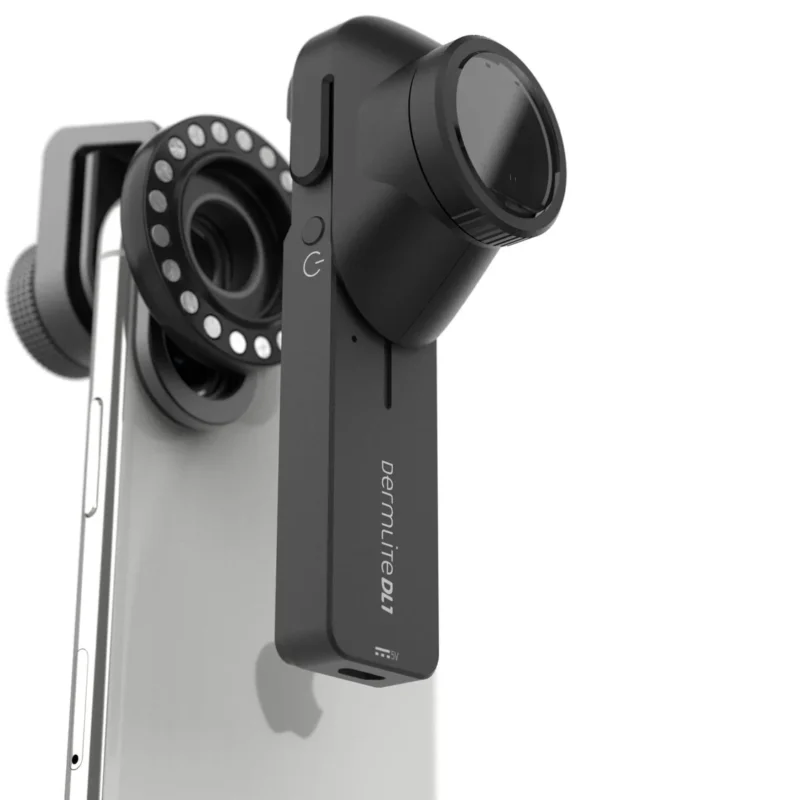 DermLite DL1